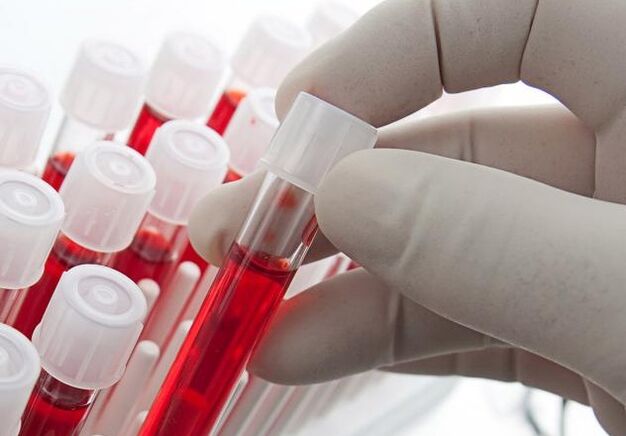 Spirtli ichimliklarni iste'mol qilgandan keyin qon sinovi